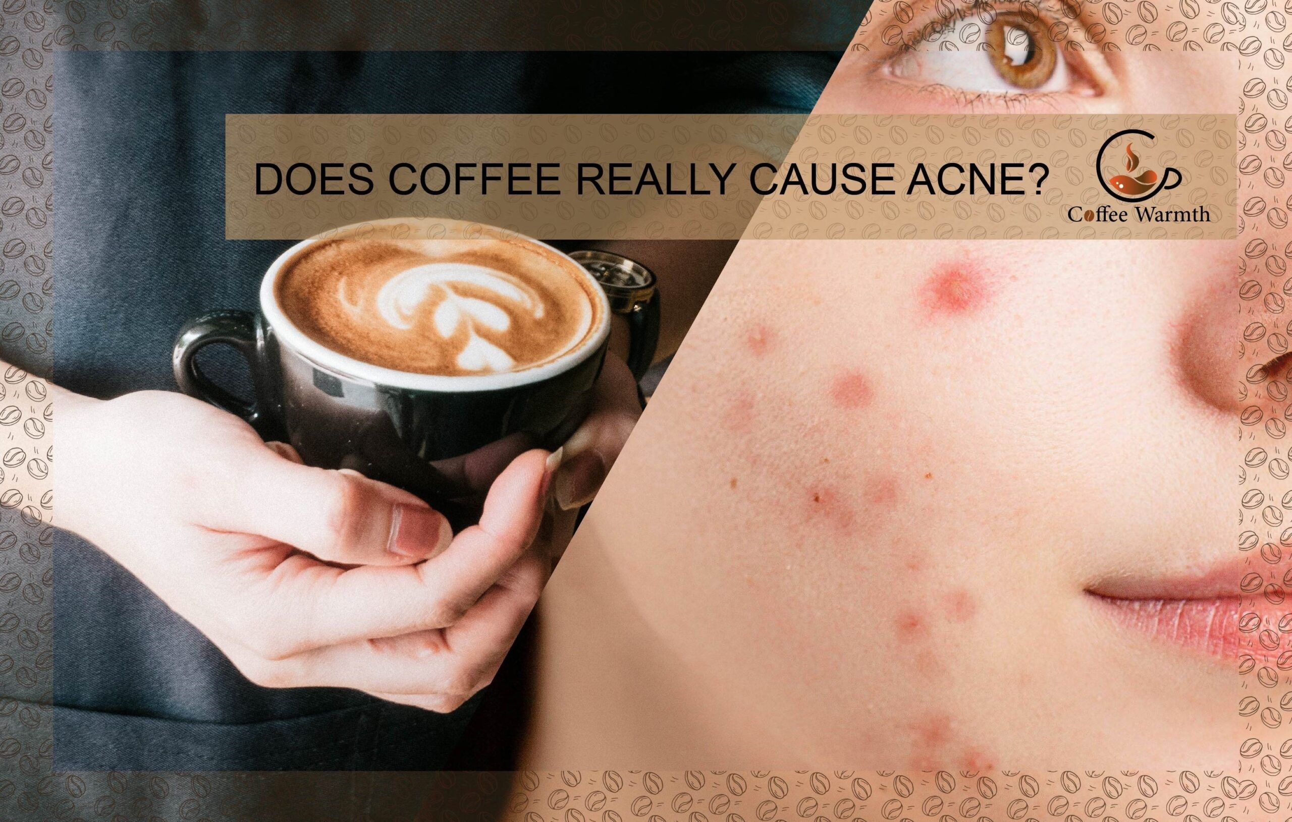 Does coffee cause acne