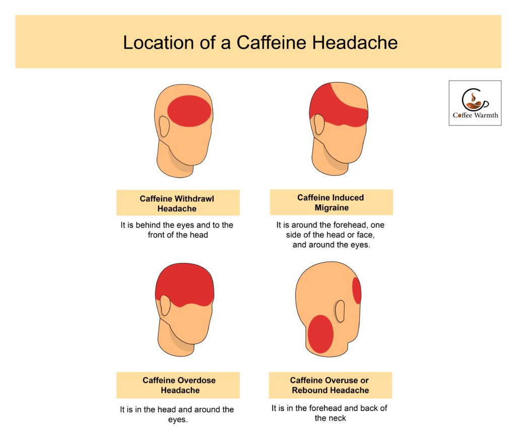 Caffeine induced headaches location